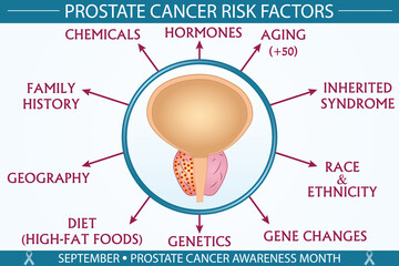 prostate cancer risk factors