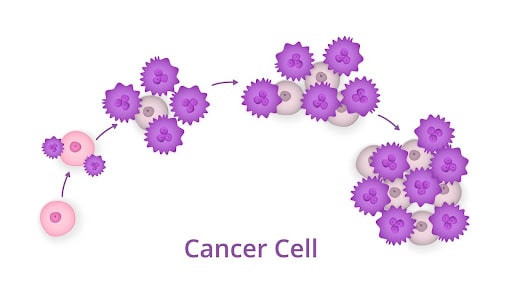 Cancer staging Kansas City